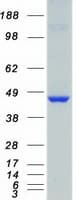 Human CAMK1D Protein (Recombinant Myc-DDK (Flag))