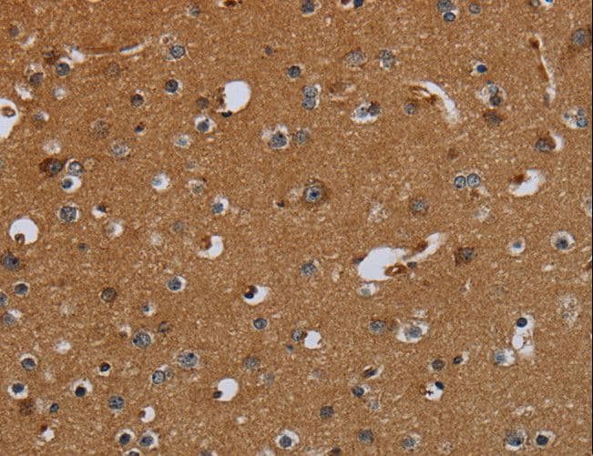 PCK2 / PEPCK Antibody