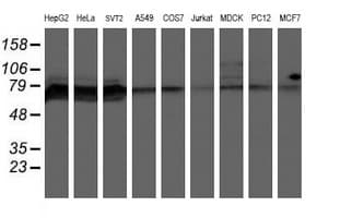 PPP1R15A / GADD34 Antibody (clone OTI3D12)
