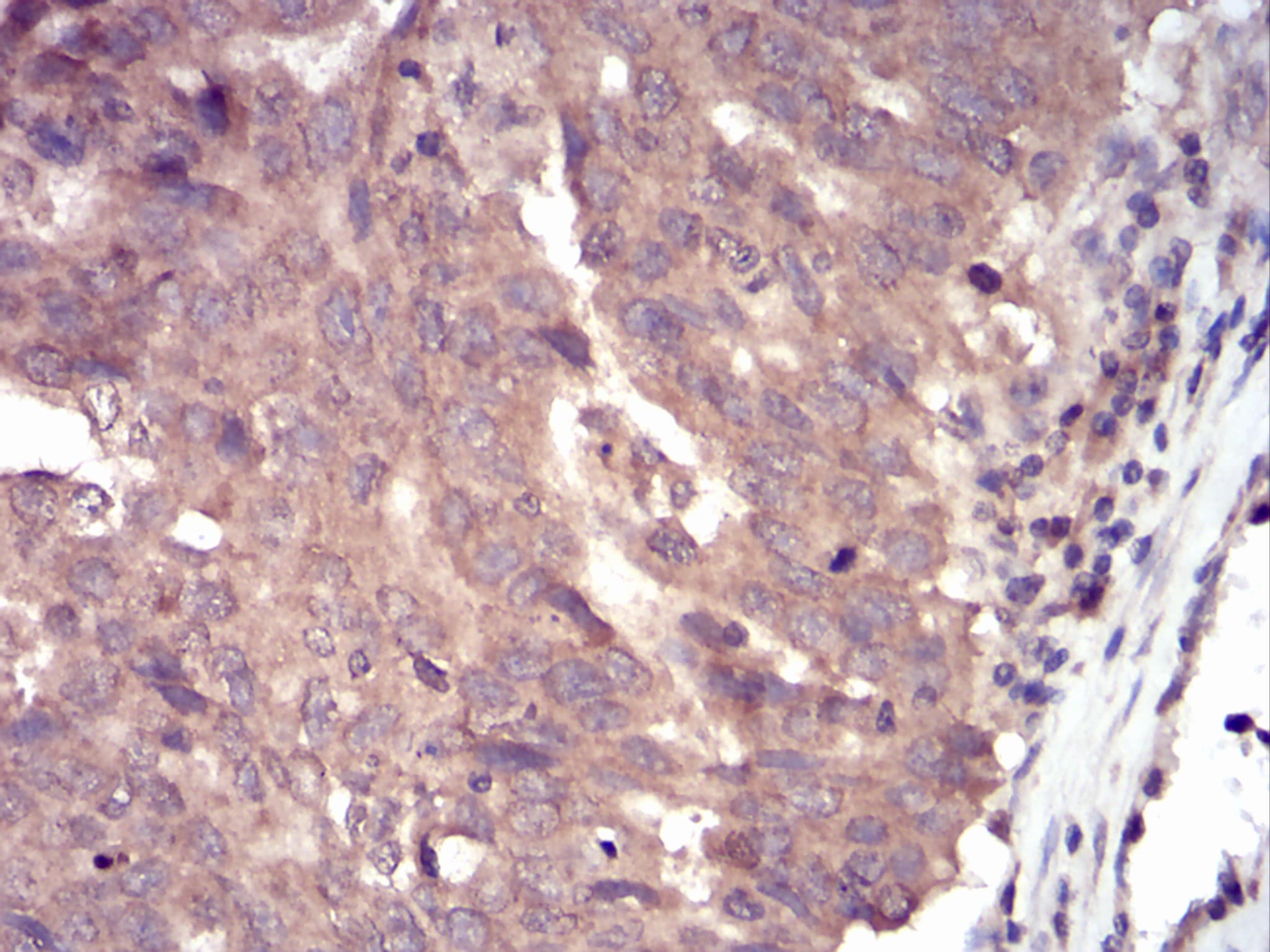 SSH1 Antibody (clone 6C11G9)