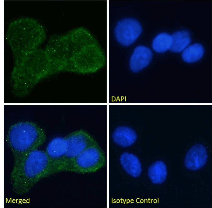 INSR / Insulin Receptor Antibody (Insulin Receptor alpha, clone Fab 83-7)