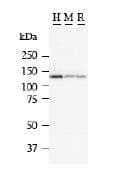MATR3 / Matrin 3 Antibody