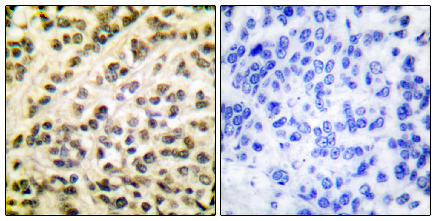 FLI1 Antibody (aa291-340)