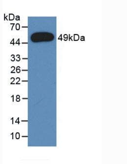 ORM1 / Orosomucoid Antibody