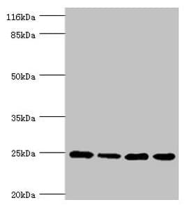 Polyclonal Rabbit anti-Human NDUFA13 / GRIM19 Antibody (IHC, WB)