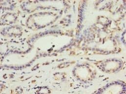 DAPK2 / DAP Kinase 2 Antibody (aa222-370)