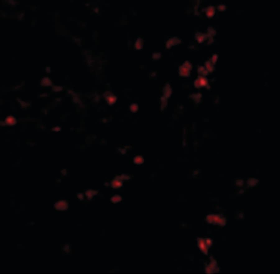 Polyclonal Rabbit anti-Human LAMP1 / CD107a Antibody (IHC, IF, WB)
