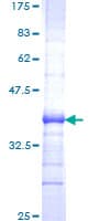 Human SCUBE3 Protein (Recombinant GST, N-terminus)