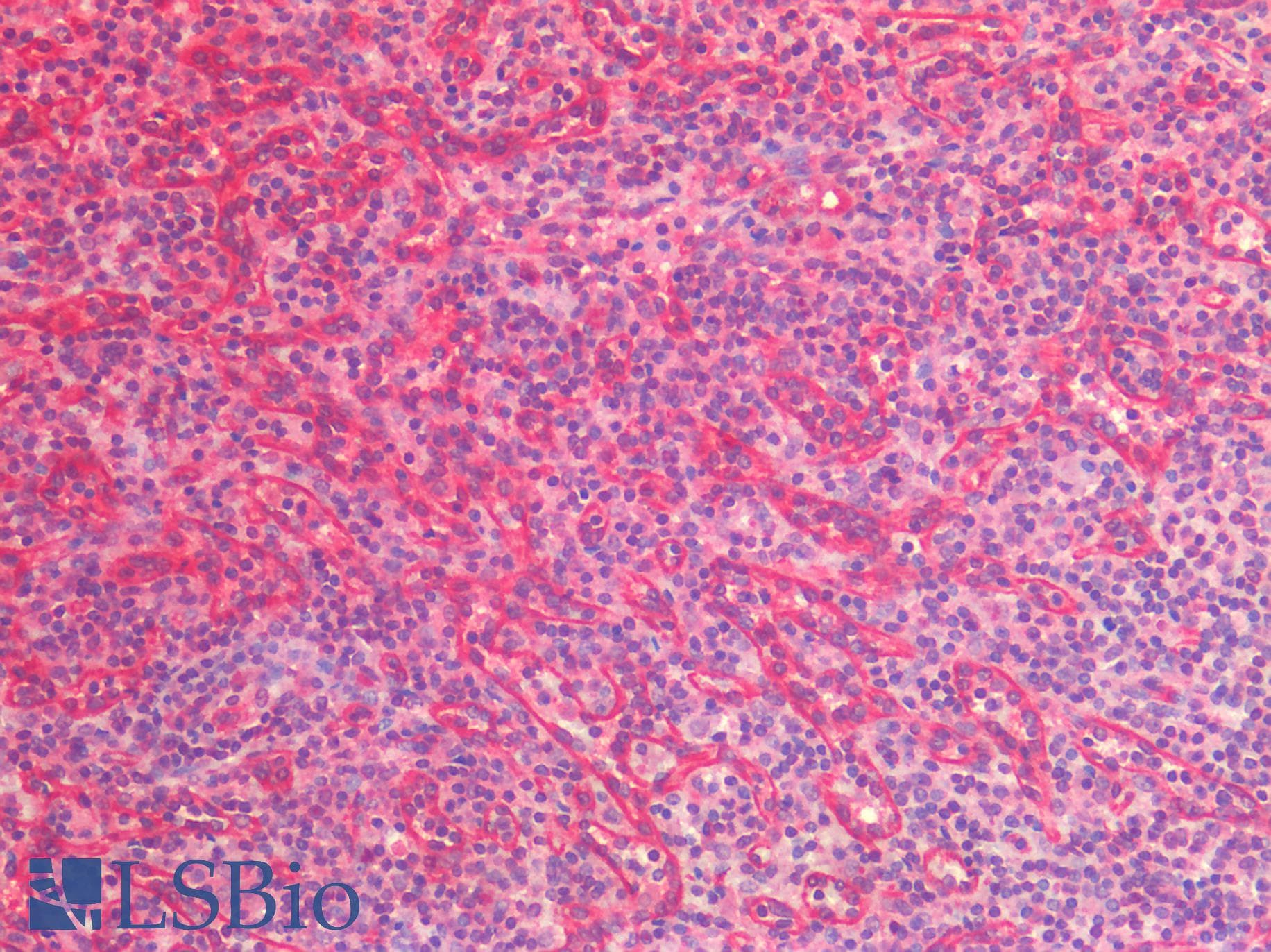 IHC-plus™ IL6 / Interleukin 6 Antibody