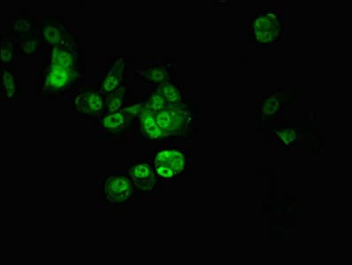 Polyclonal Rabbit anti-Human CPSF6 Antibody (IHC, IF, WB)