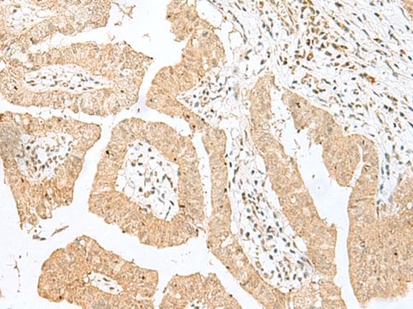 BEX2 Antibody
