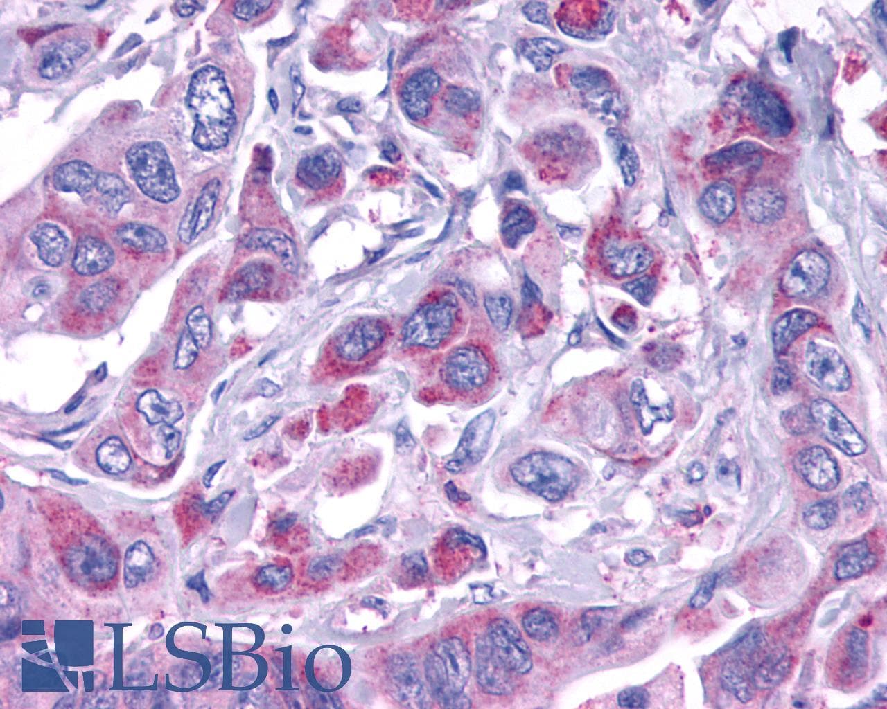 IHC-plus™ Polyclonal Rabbit anti-Human ADGRL4 / ELTD1 Antibody (N-Terminus, IHC)