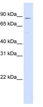 Polyclonal Rabbit anti-Human CPT1A Antibody (aa684-733, WB)