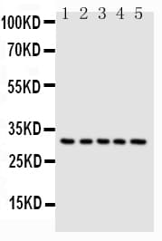 Polyclonal Rabbit anti-Human CASP6 / Caspase 6 Antibody (aa24-44, IHC, WB)