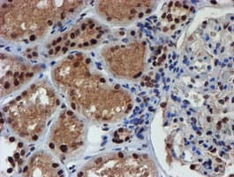 Monoclonal Mouse anti-Human RFXANK Antibody (clone OTI2B6, IHC, IF, WB)