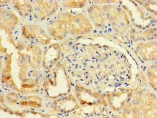Polyclonal Rabbit anti-Human FAM70B Antibody