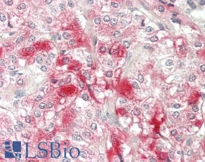 ELOVL6 Antibody (C-Terminus)