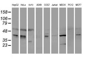 IHC-plus™ SERPINE2 / Nexin Antibody (clone 4E4)
