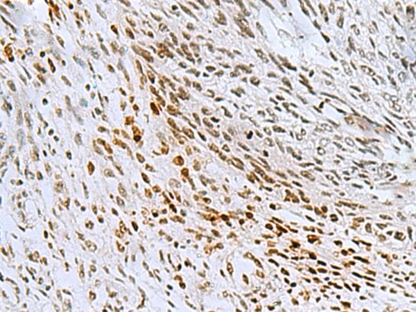 CNOT7 Antibody