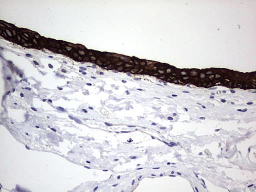 Monoclonal Rat anti-Human Acidic Cytokeratin Antibody (clone 9H3, IHC)
