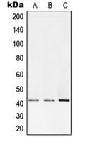 PRKACA + PRKACB Antibody (N-Terminus)