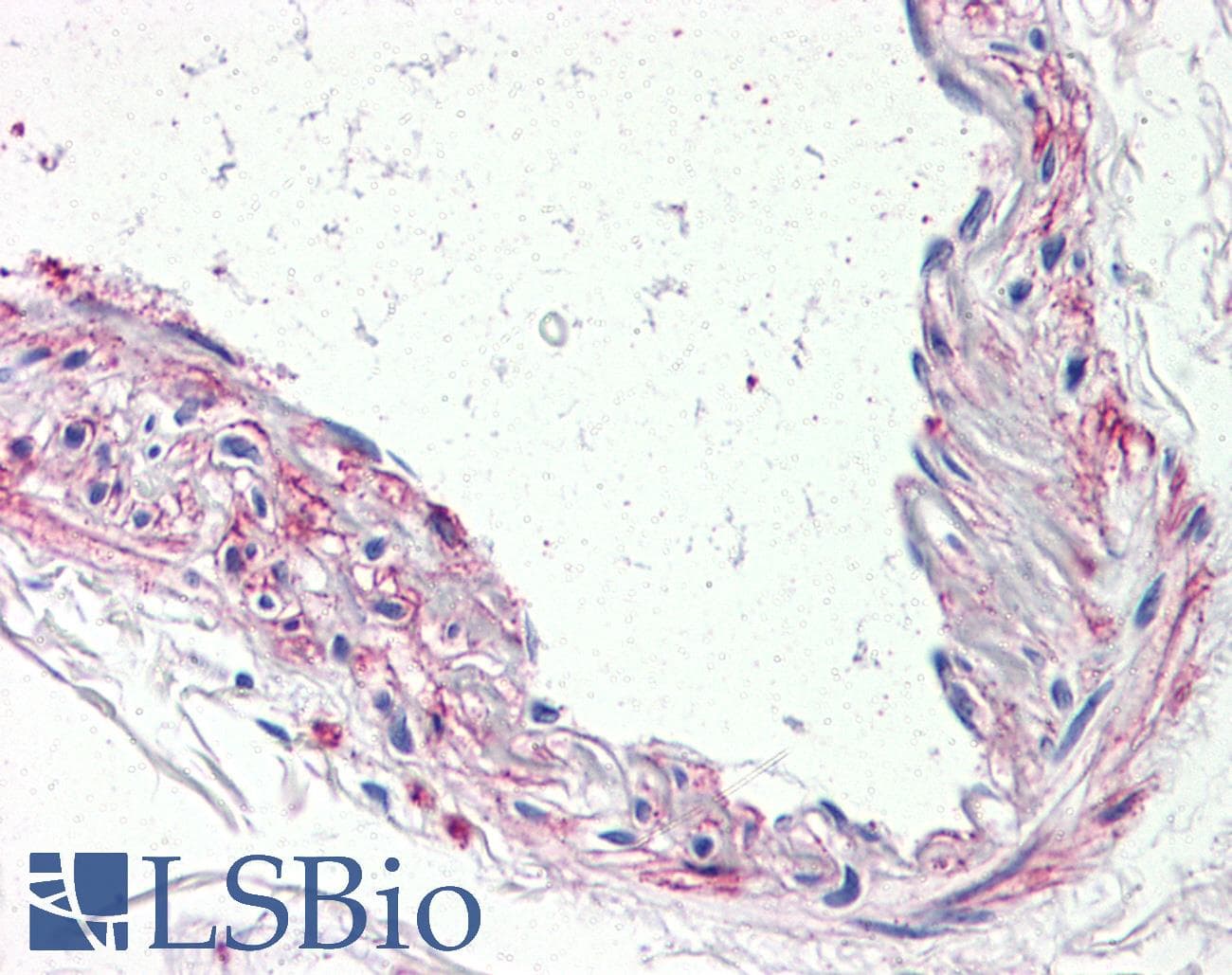 IHC-plus™ HTR1B / 5-HT1B Receptor Antibody (Internal)