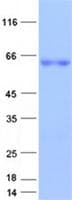 Human HOXD8 Protein (Recombinant GST, N-terminus + His, C-terminus)