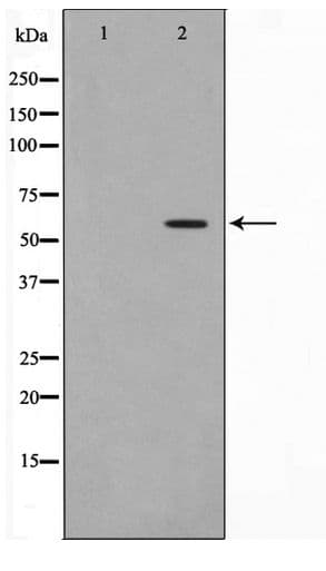 Polyclonal Rabbit anti-Human DKC1 / Dyskerin Antibody (IF, WB)