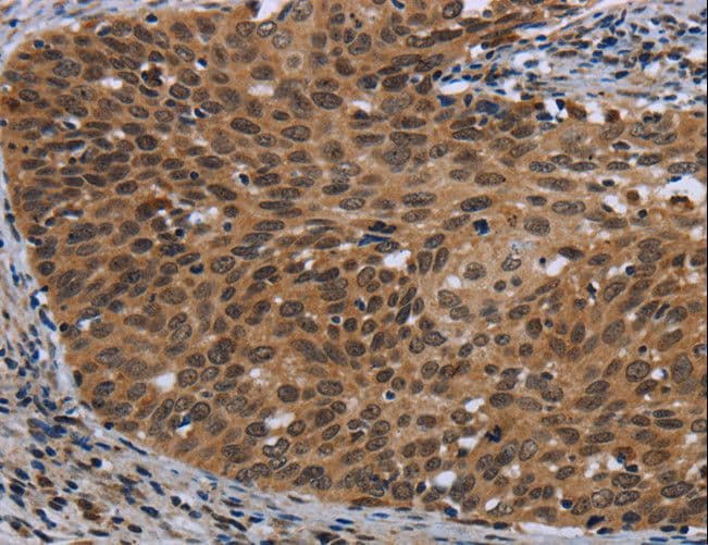 C/EBP Delta / CEBPD Antibody