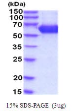 Human HEXA Protein (Recombinant His)