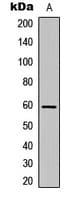 CDH23 / Cadherin 23 Antibody (aa86-125)
