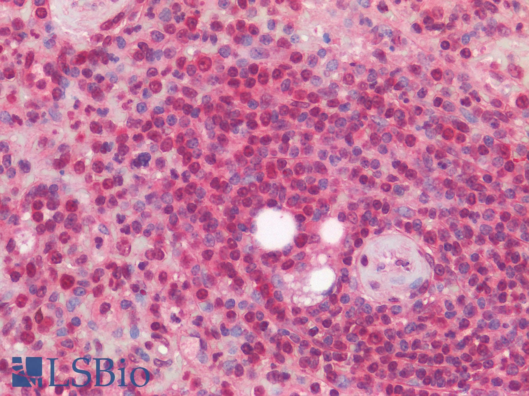 IHC-plus™ Polyclonal Rabbit anti-Human SREBF2 / SREBP2 Antibody (aa455-469, IHC, WB)