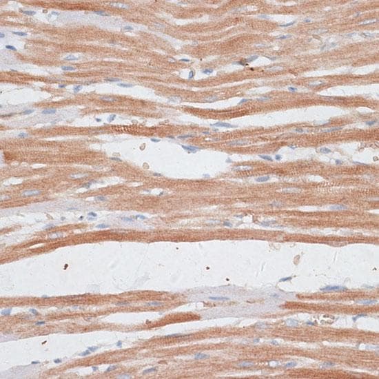 Polyclonal Rabbit anti-Human KATNA1 Antibody (IHC)