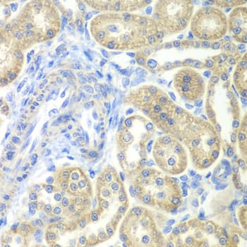 NDUFV2 Antibody