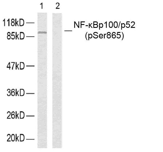 NFKB2 Antibody (phospho-Ser865)