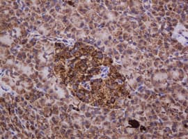 HSPD1 / HSP60 Antibody (clone OTI3G10)
