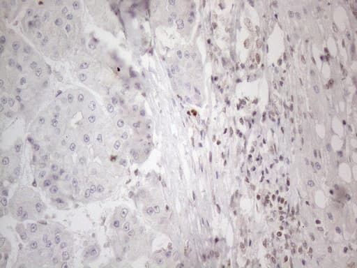 NR2C2 / TAK1 Antibody (aa1-241, clone OTI4B1)