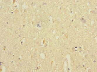 Polyclonal Rabbit anti-Human ANKS1B Antibody (IHC, WB)