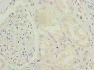 ENPP6 Antibody