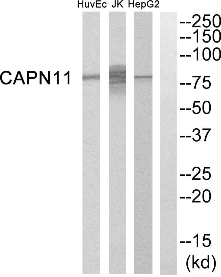 Polyclonal Rabbit anti-Human CAPN11 / Calpain 11 Antibody (WB)