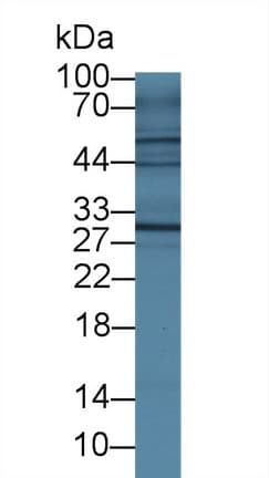 IL4R / CD124 Antibody (aa26-233)