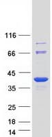 Human STUB1 / CHIP Protein (Recombinant Myc-DDK (Flag))