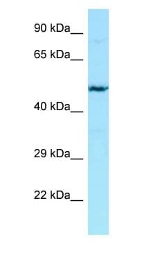 Heparanase 2 / HPSE2 Antibody (aa109-158)