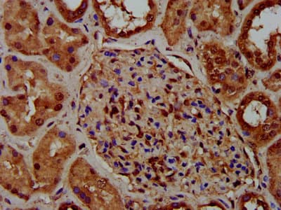 CKAP5 / ch-TOG Antibody