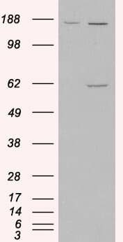 IHC-plus™ Polyclonal Goat anti-Human MAOA / Monoamine Oxidase Antibody (aa141-154, IHC, WB)