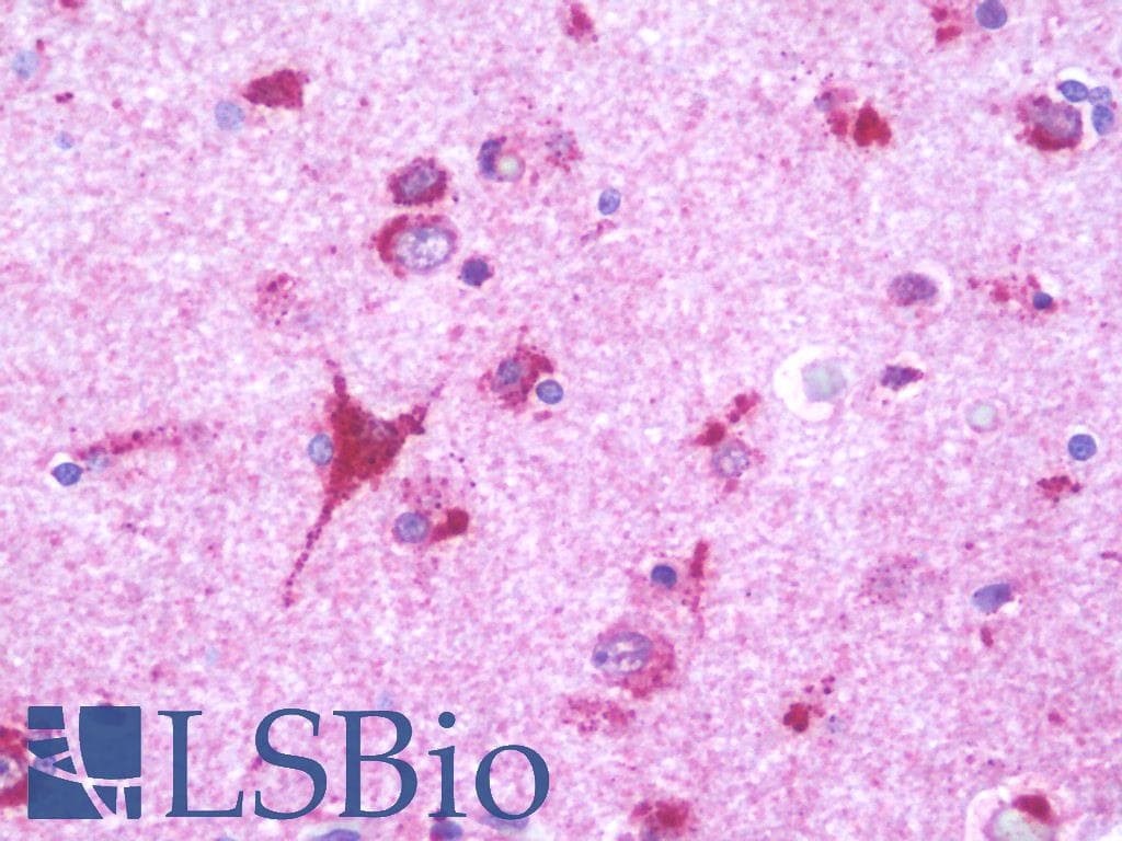 IHC-plus™ LUC7L2 Antibody (aa129-178)