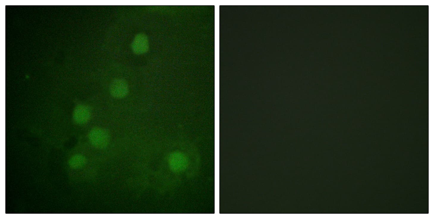 IHC-plus™ Polyclonal Rabbit anti-Human RAD52 Antibody (aa70-119, IHC, IF, WB)