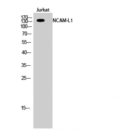 L1CAM Antibody (1120-1200 aa)