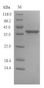Human SIRPB1 / CD172b Protein (Recombinant 6His, N-terminus)