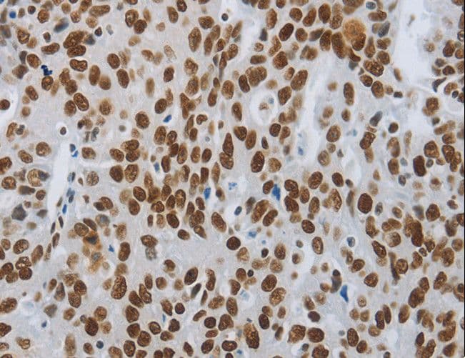 Polyclonal Rabbit anti-Human SLC16A14 / MCT14 Antibody (IHC)